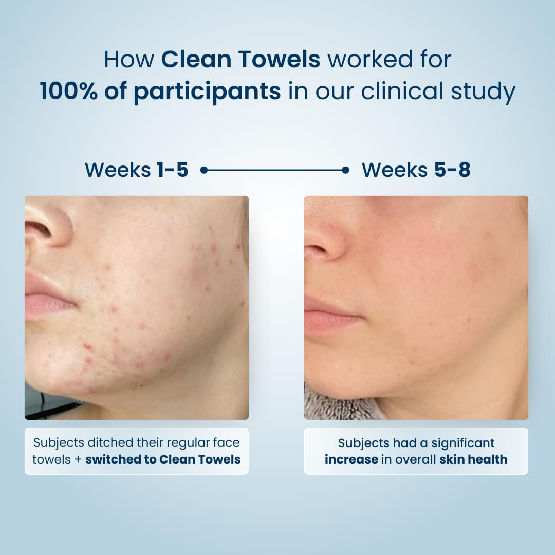 CleanSkin - Gezichtsreinigingdoekjes | Nog maar 9 sets beschikbaar!