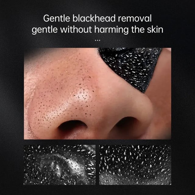 Blackhead remover acne treatment mask - odelly.nl