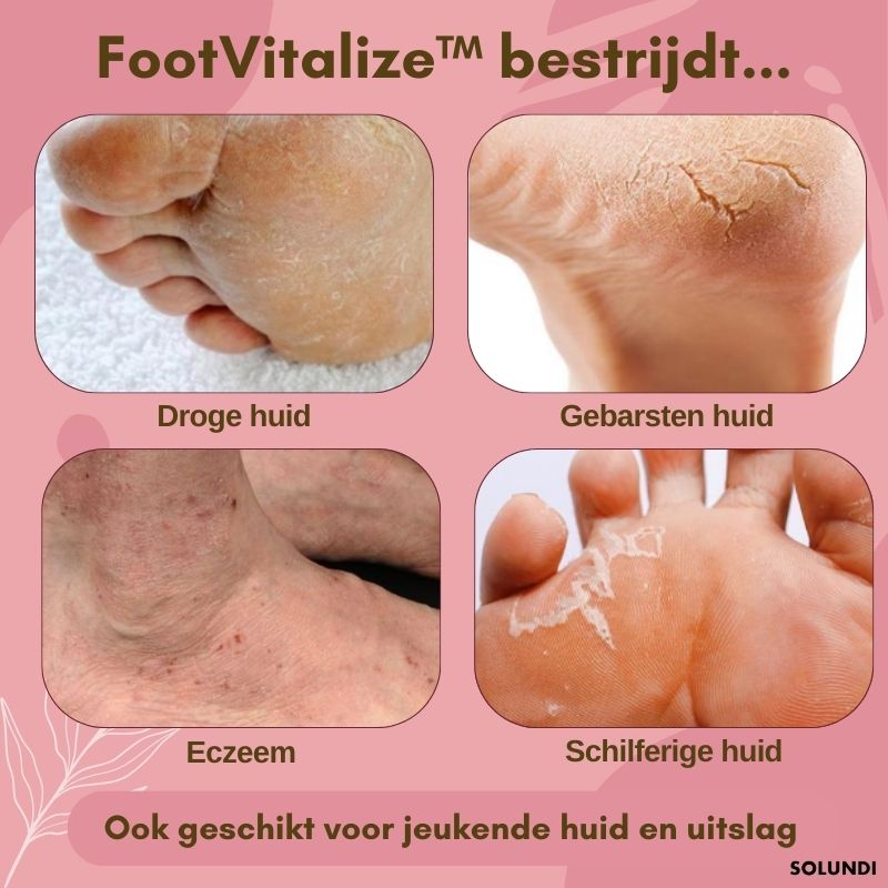 FootVitalize™ - Voetherstellende crème | LAATSTE DAG +1 GRATIS - odelly.nl