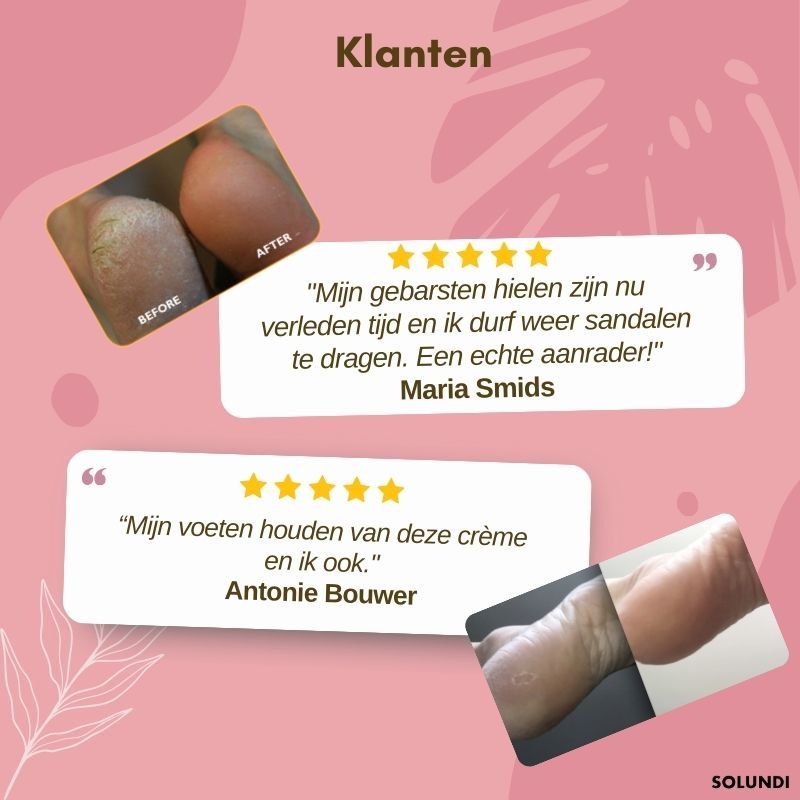 FootVitalize™ - Voetherstellende crème | LAATSTE DAG +1 GRATIS - odelly.nl