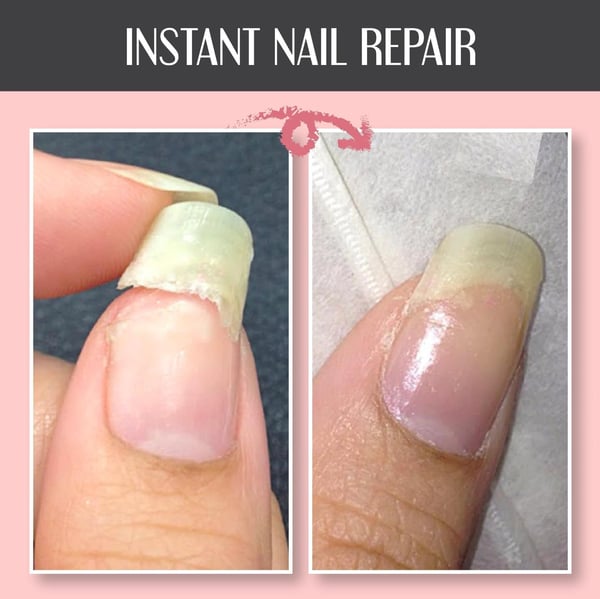 NailEssence™ Nail Repair Gel - odelly.nl