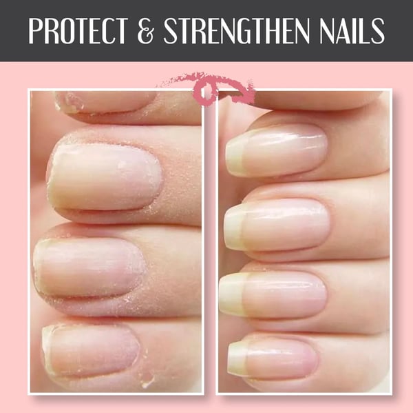 NailEssence™ Nail Repair Gel - odelly.nl