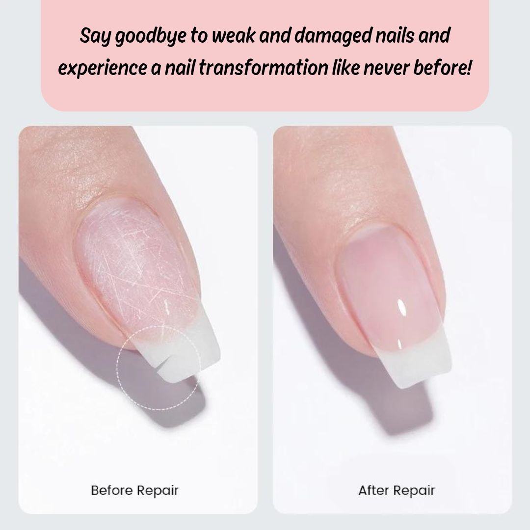NailEssence™ Nail Repair Gel - odelly.nl