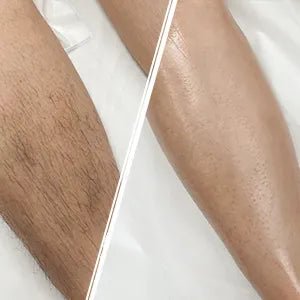 SilkSweep™ Hair Remover - odelly.nl