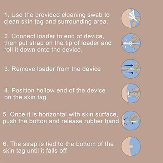 Skin Tag Removal Kit™ - odelly.nl
