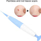 Skin Tag Removal Kit™ - odelly.nl